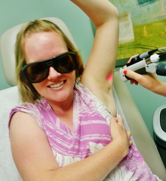 laser hair removal draper