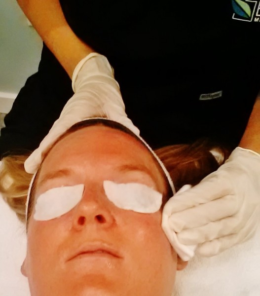 Chemical Peels Salt Lake