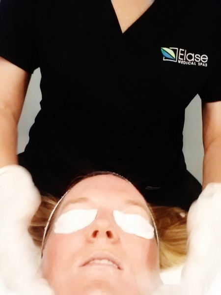 Chemical Peel Utah